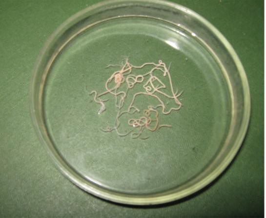 Рис. 1. Dictyocaulus filaria из легких овцы